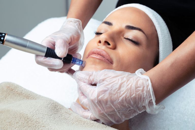 oasis iv medspa microneedling