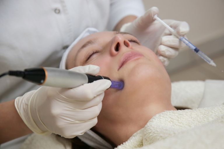 Micro Needling Treatment