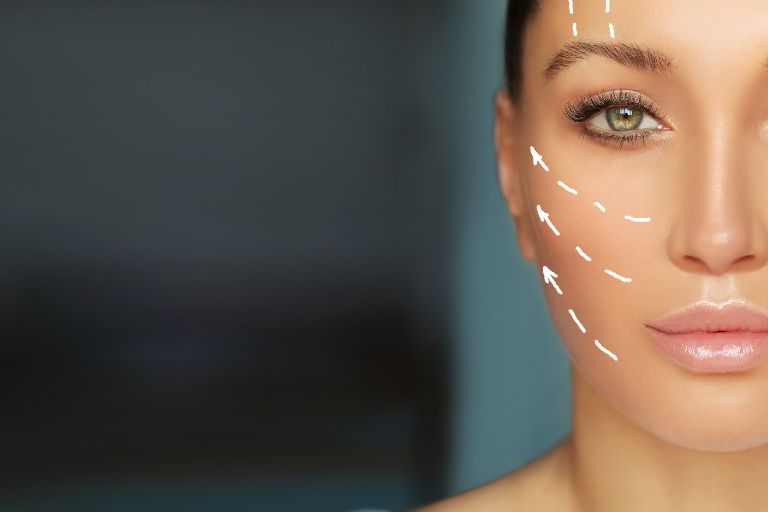 Liquid Facelift