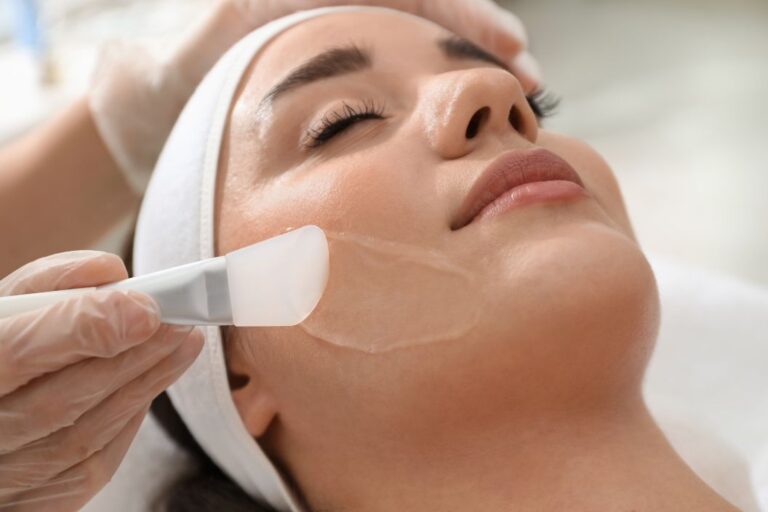 face peel